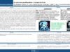 565_Chaabouni_Mohamed-Amin_P116-Le-carcinome-parathyroidien