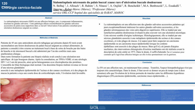 569_Belhaj_Najoua_P120—Sialométaplasie-nécrosante-du-palais-buccal -cause-rare-d’ulcération-buccale-douleureuse