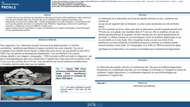 570_Belhaj_Najoua_P121-La-tuberculose-parotidienne-a-propos-de-5-cas-colliges-de-2012-a-2020-dans-le-service-ORL-CCF-CHU-Rabat