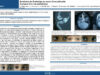 578_CHOUCHANE_Lobna_P129-Syndrome-de-Gradenigo-au-cours-dune-petrosite-a-propos-dun-cas-pediatrique