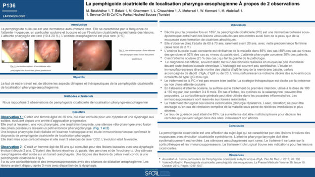 587_Belaid_Takwa_P136-La-pemphigoide-cicatricielle-de-localisation-pharyngo-oesophagienne-A-propos-de-2-observations