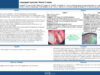 589_Chaabouni_Mohamed-Amin_P138-Laryngeal-myxoma-About-2-cases