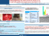 592_Bouatay_rachida_P141-Profil-ganglionnaire-des-cancers-du-larynx-classes-T3-T4