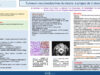 597_El-omri_Malika_P146-Tumeur-neuroendocrine-du-larynx-a-propos-de-deux-observations