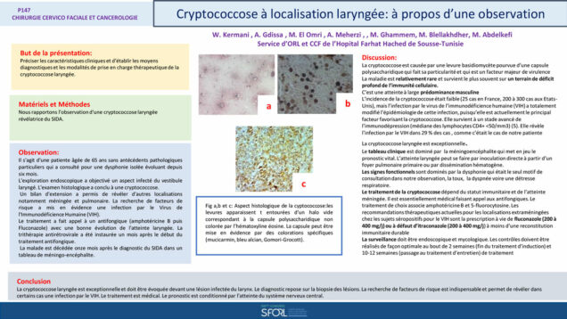 598_El-omri_Malika_P147-Cryptococcose-a-localisation-laryngee-A-propos-dune-observation