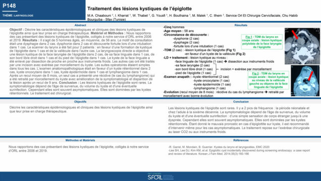 599_Chaabouni_Mohamed-Amin_P148-Traitement-des-lesions-kystiques-de-lepiglotte