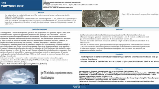 600_Belhaj_Najoua_P149-Tuberculose-laryngee-diagnostiquee-dans-un-tableau-de-dyspnee-laryngee