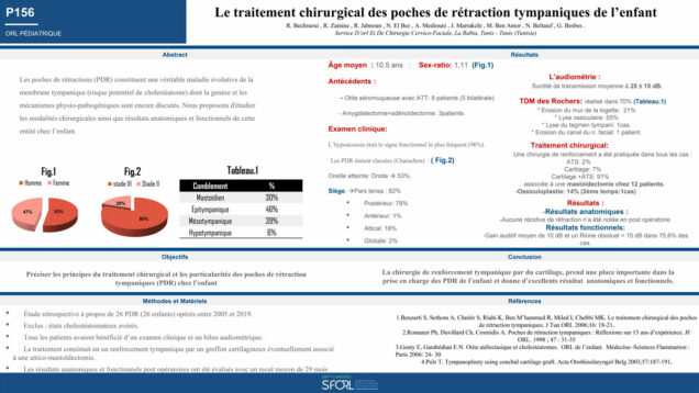608_JABNOUN_Ramzi_P156-Le-traitement-chirurgical-des-poches-de-retraction-tympaniques-de-lenfant