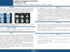 610_benyahia_zaineb_P158-Lymphome-amygdalien-chez-lnfant-a-propos-dun-cas