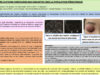 622_SAADOULI_Dorsaf_P170-Les-complications-orbitaires-des-sinusites-chez-la-population-pediatrique