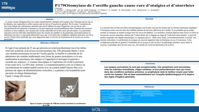 630_Belhaj_Najoua_P179-Otomyiase-de-loreille-gauche-cause-rareotalgies-et-otorrhees