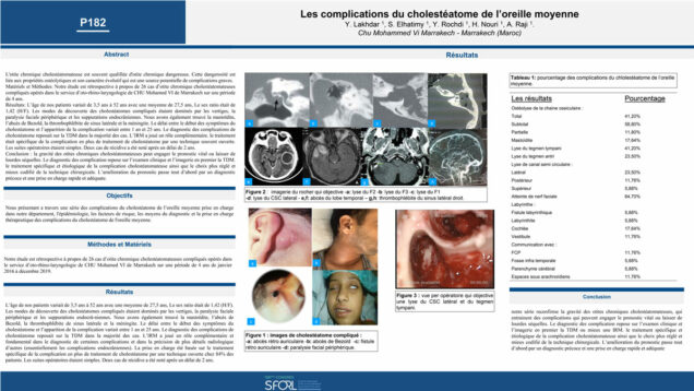 633_Lakhdar_Youssef_P182-Les-complications-du-cholesteatome-de-loreille-moyenne