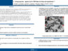 642_Mkhatri_Amine_P191-Lotospongiose-apport-de-la-TDM-dans-le-bilan-preoperatoire