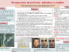 648_Jellali_Sondes_P197-Decompression-du-nerf-facial-indications-et-resultats