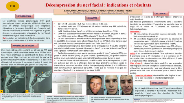 648_Jellali_Sondes_P197-Decompression-du-nerf-facial-indications-et-resultats