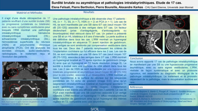 649_FELISATI_Elena-Giulia_P198-Surdite-brutale-ou-asymetrique-et-pathologies-intralabyrinthiques