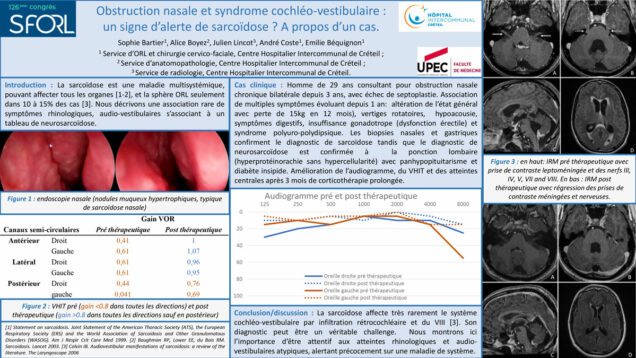 650_BARTIER_Sophie_P199-Obstruction-nasale-et-syndrome-cochleo-vestibulaire-un-signe-dalerte-de-sarcoidose-A-propos-dun-cas