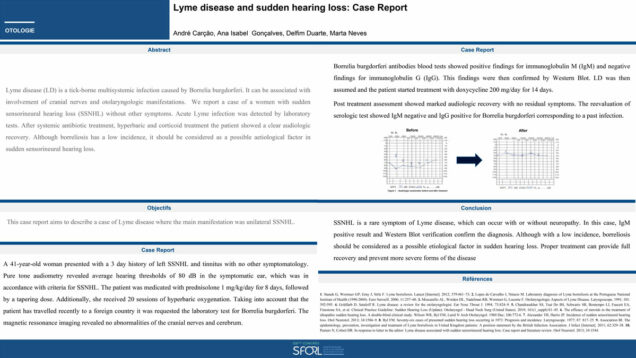 651_Carcao_Andre_P200-Lyme-disease-and-sudden-hearing-loss-Case-Report