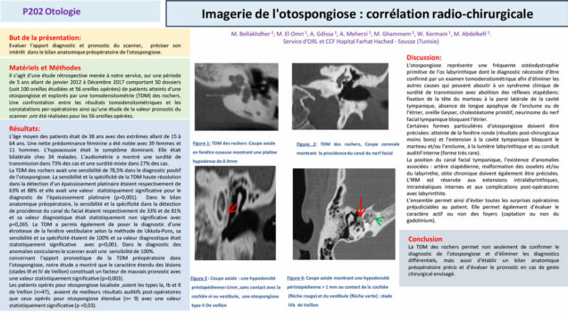 653_El-omri_Malika_P202-Imagerie-de-lotospongiose-correlation-radio-chirurgicale