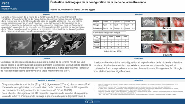 656_Mostafa_Badr_P205-Evaluation-radiologique-de-la-configuration-de-la-niche-de-la-fenetre-ronde