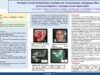 659_El-omri_Malika_P208-Paralysie-faciale-peripherique-revelant-une-mucormycose-otologique-chez-un-sujet-immunocompetent