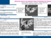 664_rim_fradi_P213-Interet-du-scanner-pre-operatoire-dans-le-traitement-de-lotospongiose