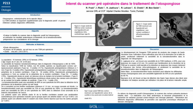 664_rim_fradi_P213-Interet-du-scanner-pre-operatoire-dans-le-traitement-de-lotospongiose