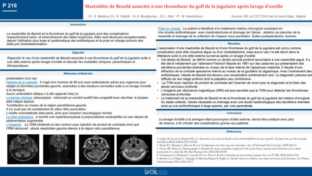 667_MEDKOUR_SAMIRA_P216-Mastoidite-de-bezold-associee-a-une-thrombose-du-golf-de-la-jugulaire-apres-un-lavage-doreille-externe