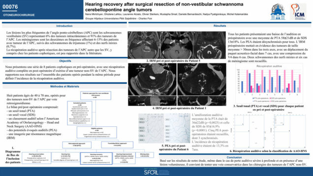 679_BERNARDESCHI_DANIELE_P228-Amelioration-auditive-apres-chirurgie-des-lesions-de-langle-ponto-cerebelleux