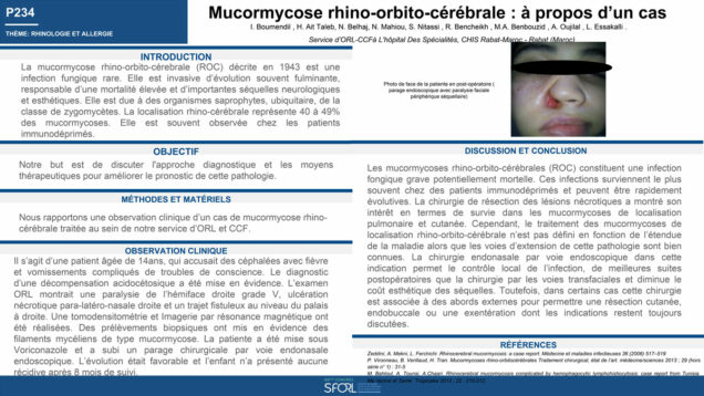686_Boumendil_Ikrame_P234-Mucormycose-rhino-orbito-cerebrale-a-propos-dun-cas