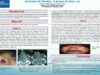 687_MOUNJI_HOUDA_P235-Le-syndrome-de-Woakes-a-propos-de-deux-cas