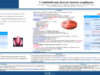 694_JABNOUN_Ramzi_P242-Lantibiotherapie-dans-les-sinusites-compliquees