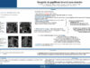 695_JABNOUN_Ramzi_P243-Imagerie-du-papillome-inverse-naso-sinusien