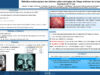 703_KHARRAT_INES_P251-Refection-endoscopique-des-breches-osteo-meningees-de-letage-anterieur-de-la-base-du-crane-A-propos-de-17-cas