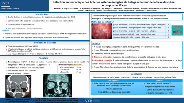 703_KHARRAT_INES_P251-Refection-endoscopique-des-breches-osteo-meningees-de-letage-anterieur-de-la-base-du-crane-A-propos-de-17-cas