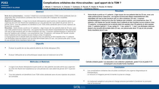 705_Mkhatri_Amine_P253-Complications-orbitaires-des-rhinosinusites-quel-interet-de-la-TDM