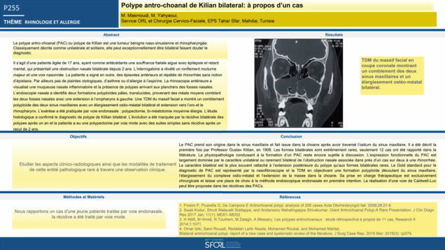 707_Masmoudi_mohamed_P255-Polype-antro-choanal-de-Kilian-bilateral-a-propos-dun-cas