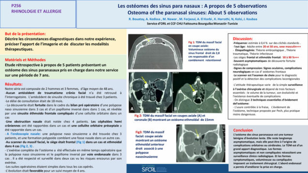 708_Bouatay_rachida_P256-Les-osteomes-des-sinus-paranasaux-A-propos-de-5-observations