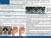 712_KHALED_Harrathi_P260-Cause-inhabituelle-dobstruction-nasale-bilaterale-chez-ladulte-a-propos-dun-cas