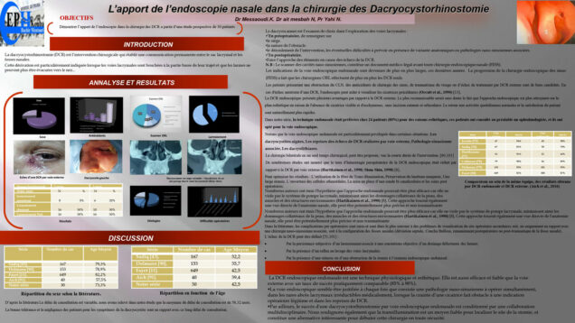 717_MESSAOUDI_Karim_P265-Lapport-de-lndoscopie-nasale-dans-la-chirurgie-des-Dacryocystorhinostomies-etude-de-30-cas