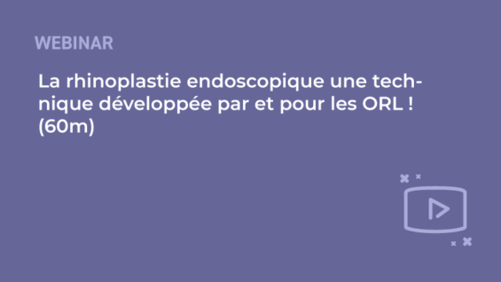 SFORL_VIEWR_-template-vignettes-replay