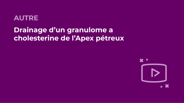 SFORL_VIEWR_video_vignettes-COMMUNAUTEORL101