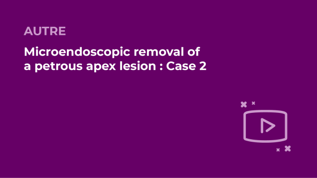 SFORL_VIEWR_video_vignettes-COMMUNAUTEORL123