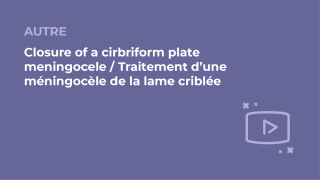 SFORL_VIEWR_video_vignettes-COMMUNAUTEORL156