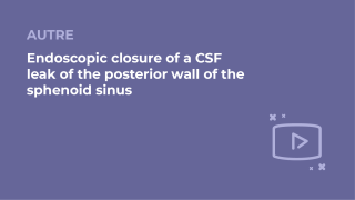 SFORL_VIEWR_video_vignettes-COMMUNAUTEORL160