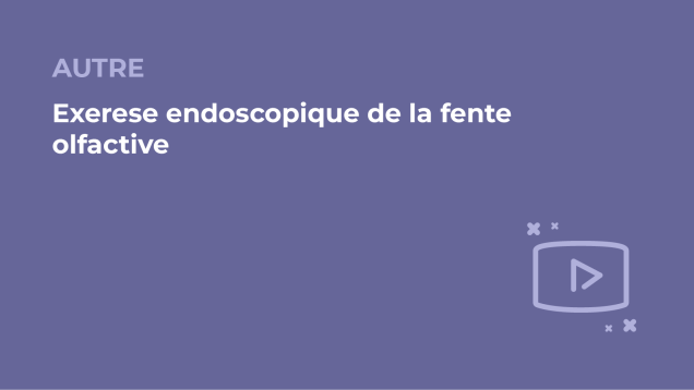 SFORL_VIEWR_video_vignettes-COMMUNAUTEORL162