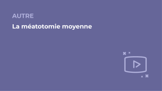 SFORL_VIEWR_video_vignettes-COMMUNAUTEORL170