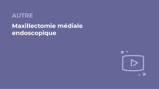 SFORL_VIEWR_video_vignettes-COMMUNAUTEORL175