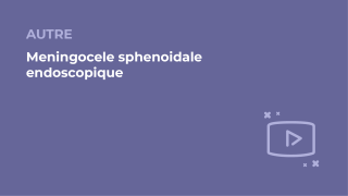 SFORL_VIEWR_video_vignettes-COMMUNAUTEORL176