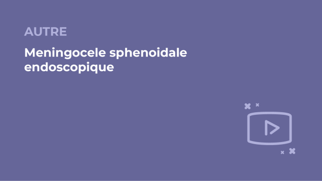 SFORL_VIEWR_video_vignettes-COMMUNAUTEORL176